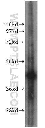 ING3 Antibody in Western Blot (WB)