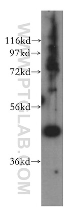 ING3 Antibody in Western Blot (WB)