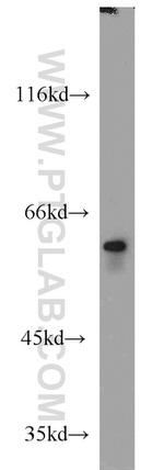 FRK Antibody in Western Blot (WB)