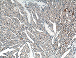 PLEKHM1 Antibody in Immunohistochemistry (Paraffin) (IHC (P))