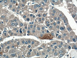 PLEKHM1 Antibody in Immunohistochemistry (Paraffin) (IHC (P))