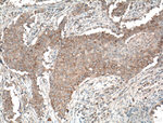 PLEKHM1 Antibody in Immunohistochemistry (Paraffin) (IHC (P))