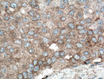 PLEKHM1 Antibody in Immunohistochemistry (Paraffin) (IHC (P))