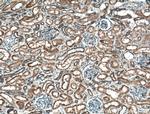 PLEKHM1 Antibody in Immunohistochemistry (Paraffin) (IHC (P))