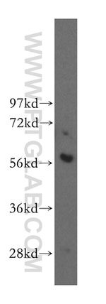 TOE1 Antibody in Western Blot (WB)