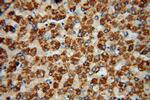 ACSS3 Antibody in Immunohistochemistry (Paraffin) (IHC (P))