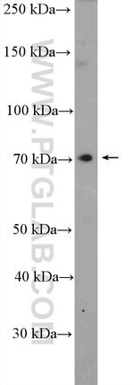 ACSS3 Antibody in Western Blot (WB)