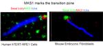 MKS1 Antibody in Immunocytochemistry (ICC/IF)