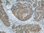 MKS1 Antibody in Immunohistochemistry (Paraffin) (IHC (P))