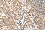 MKS1 Antibody in Immunohistochemistry (Paraffin) (IHC (P))