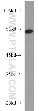 MTF2 Antibody in Western Blot (WB)