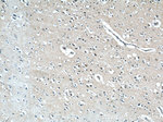 GGCX Antibody in Immunohistochemistry (Paraffin) (IHC (P))