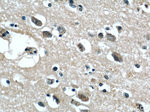 GGCX Antibody in Immunohistochemistry (Paraffin) (IHC (P))