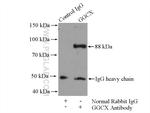 GGCX Antibody in Immunoprecipitation (IP)