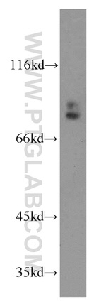 GGCX Antibody in Western Blot (WB)