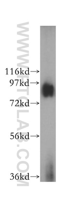 GGCX Antibody in Western Blot (WB)