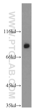 GGCX Antibody in Western Blot (WB)