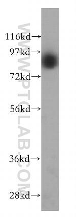 GGCX Antibody in Western Blot (WB)