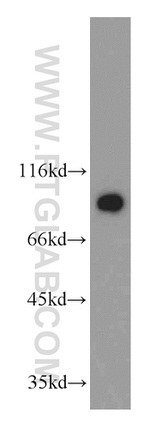 GGCX Antibody in Western Blot (WB)