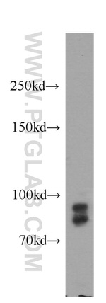 GGCX Antibody in Western Blot (WB)