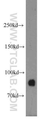 GGCX Antibody in Western Blot (WB)
