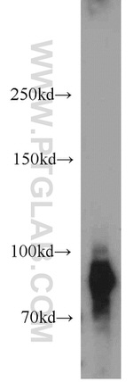 GGCX Antibody in Western Blot (WB)