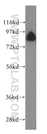 GGCX Antibody in Western Blot (WB)