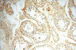 ASS1 Antibody in Immunohistochemistry (Paraffin) (IHC (P))