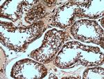 ASS1 Antibody in Immunohistochemistry (Paraffin) (IHC (P))