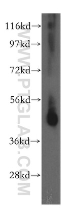 ASS1 Antibody in Western Blot (WB)