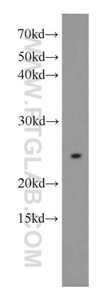 N6AMT1 Antibody in Western Blot (WB)