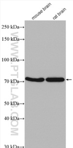 KLHL22 Antibody in Western Blot (WB)