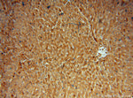 ACAT1 Antibody in Immunohistochemistry (Paraffin) (IHC (P))