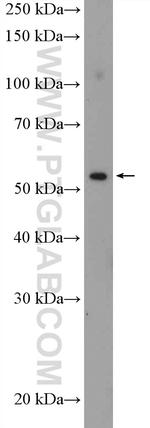 ZNF446 Antibody in Western Blot (WB)