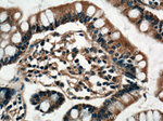VPS39 Antibody in Immunohistochemistry (Paraffin) (IHC (P))
