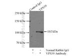 VPS39 Antibody in Immunoprecipitation (IP)