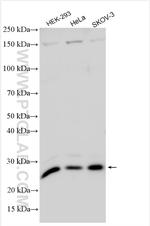 RPL10L Antibody in Western Blot (WB)