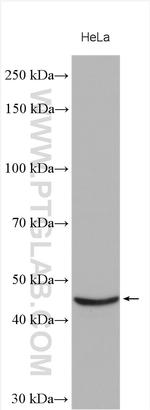 STK32A Antibody in Western Blot (WB)