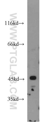 STK32A Antibody in Western Blot (WB)