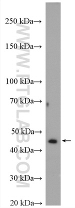 STK32A Antibody in Western Blot (WB)