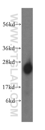 MRPL24 Antibody in Western Blot (WB)