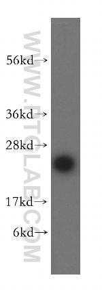 MRPL24 Antibody in Western Blot (WB)