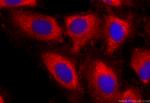 ABI3 Antibody in Immunocytochemistry (ICC/IF)