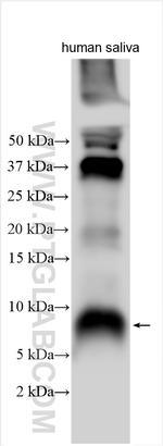ABI3 Antibody in Western Blot (WB)