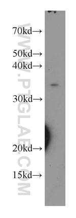 KDSR Antibody in Western Blot (WB)