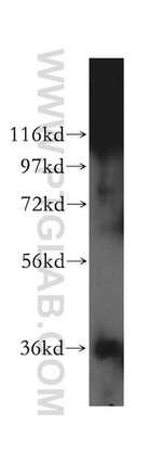 KDSR Antibody in Western Blot (WB)
