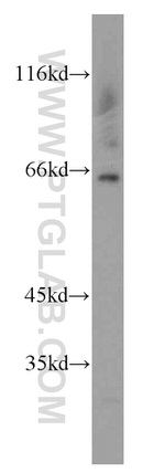 HEXB Antibody in Western Blot (WB)