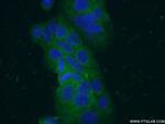 VIP Antibody in Immunocytochemistry (ICC/IF)