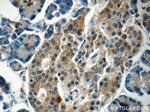 Carboxypeptidase A3 Antibody in Immunohistochemistry (Paraffin) (IHC (P))