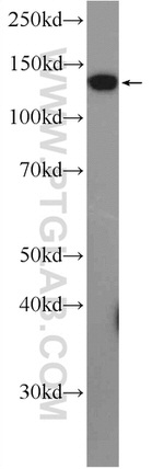 KRI1 Antibody in Western Blot (WB)
